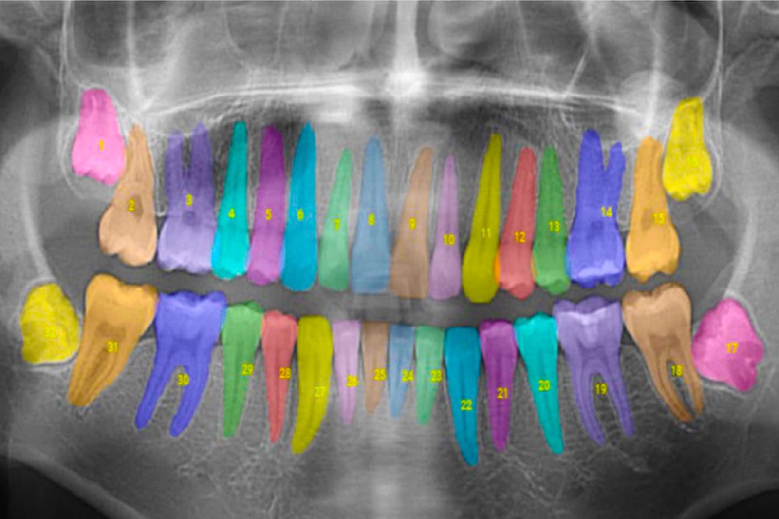 Leading the Way in AI Dentistry: Our Transformative Experience with the Apteryx AI Diagnosing Tool