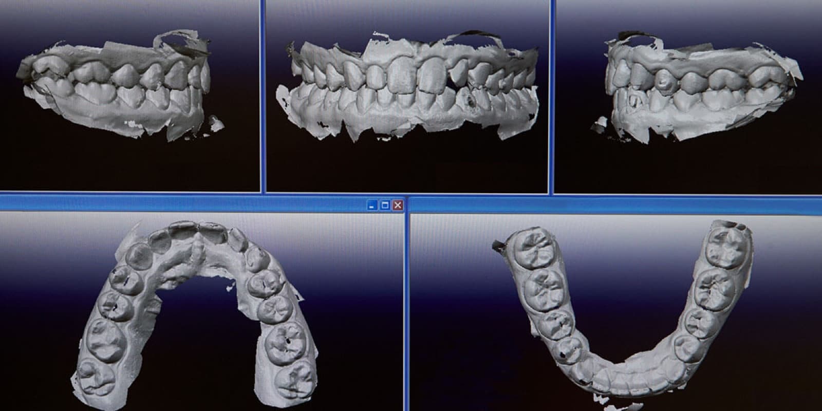 Revolutionizing Oral Health: Understanding the Role of Advanced Dental Technologies